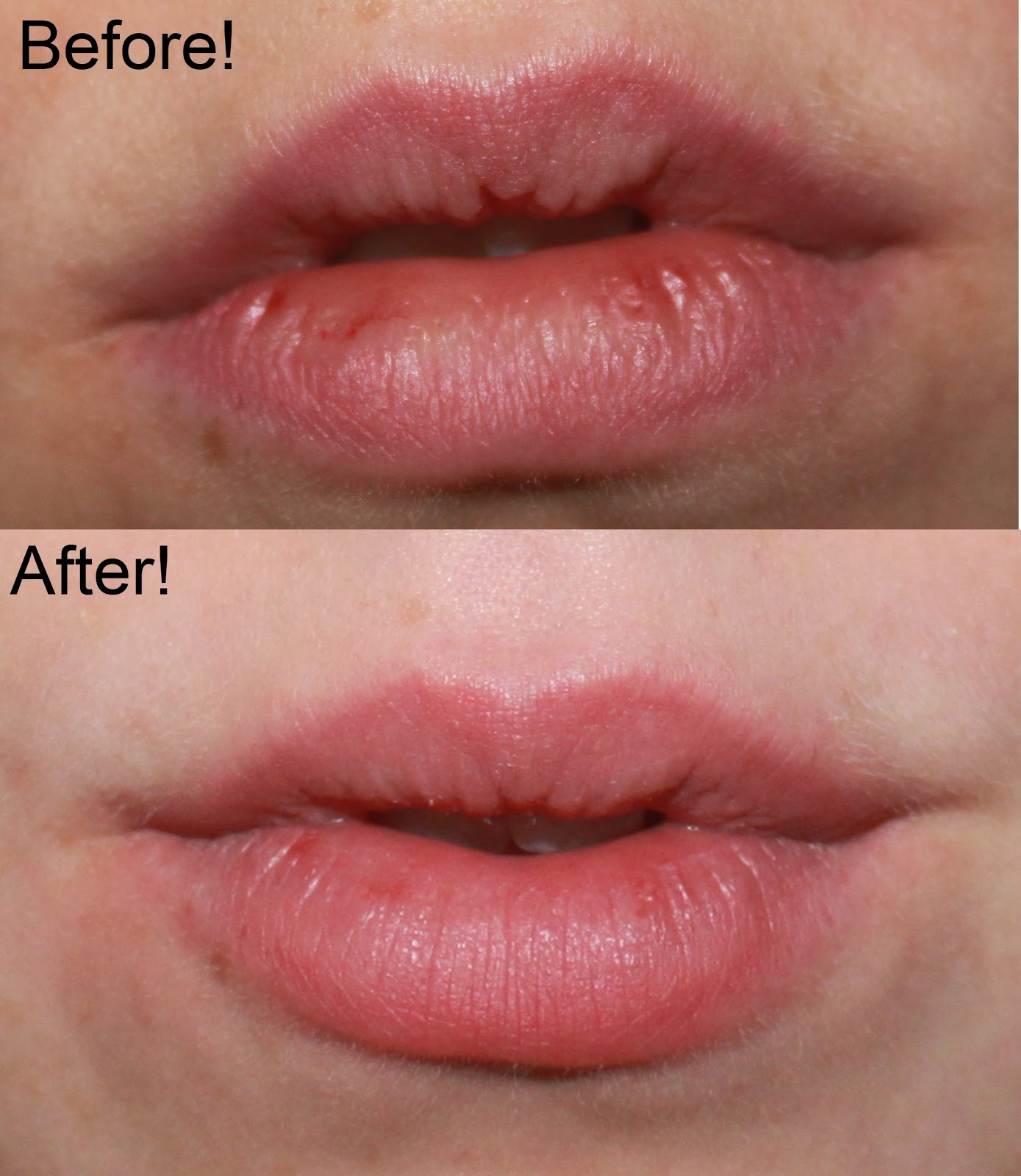 Trước và sau khi sử dụng tẩy da chết môi Lush